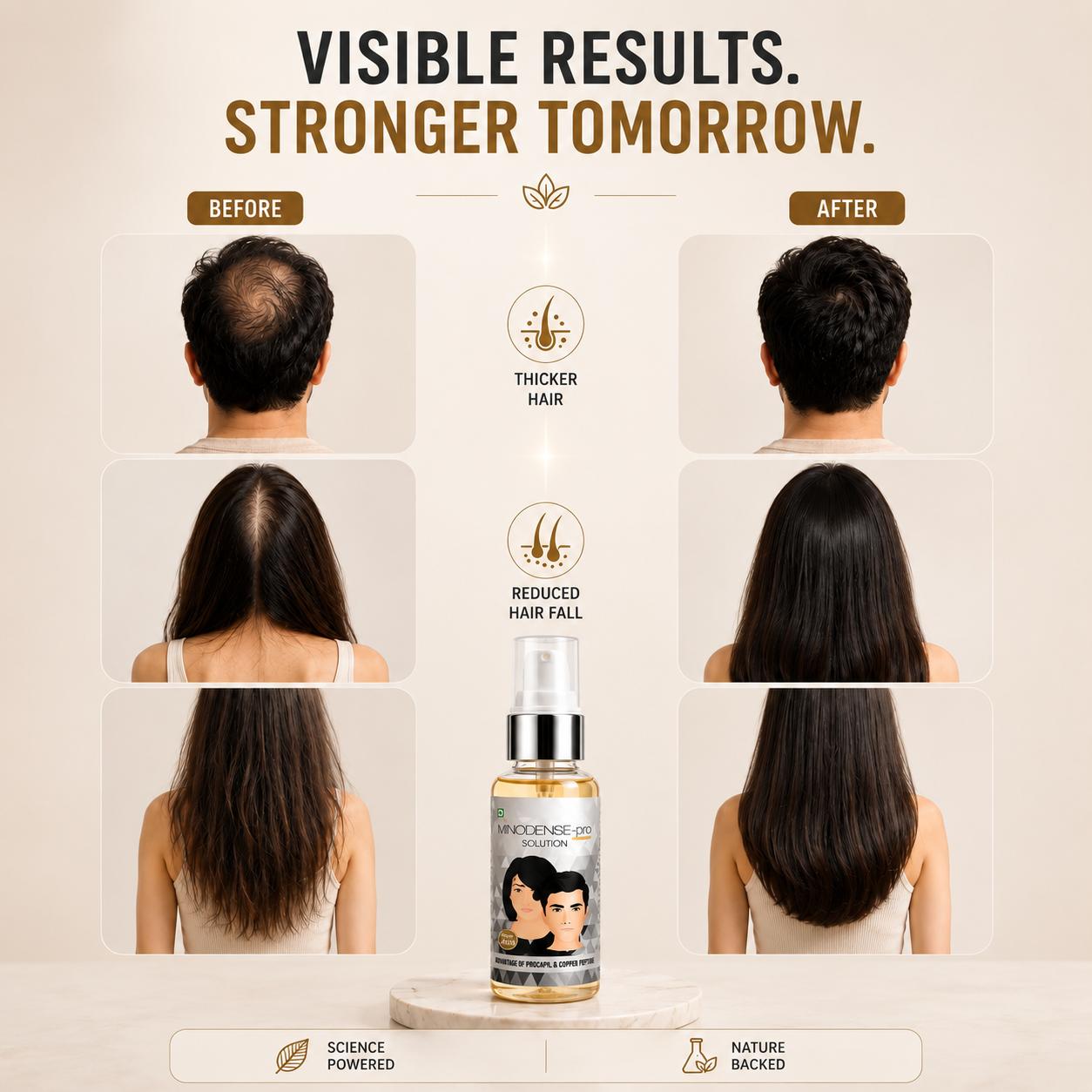 MINODENSE PRO Hair Growth & Hair Fall Control Solution with Procapil & Copper Peptide, 45 ml